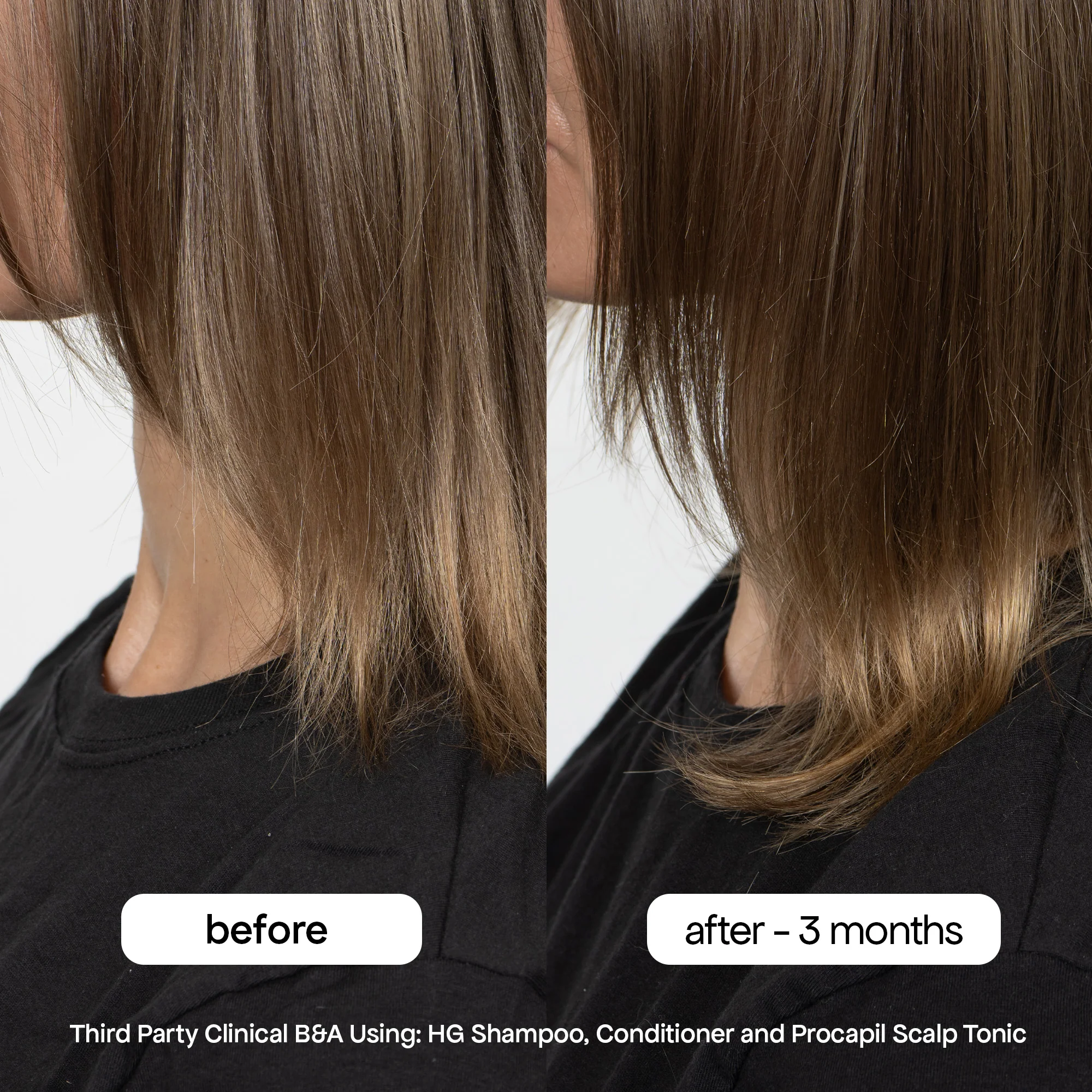 ANTI-THINNING PROCAPIL® SCALP TONIC - Image 5