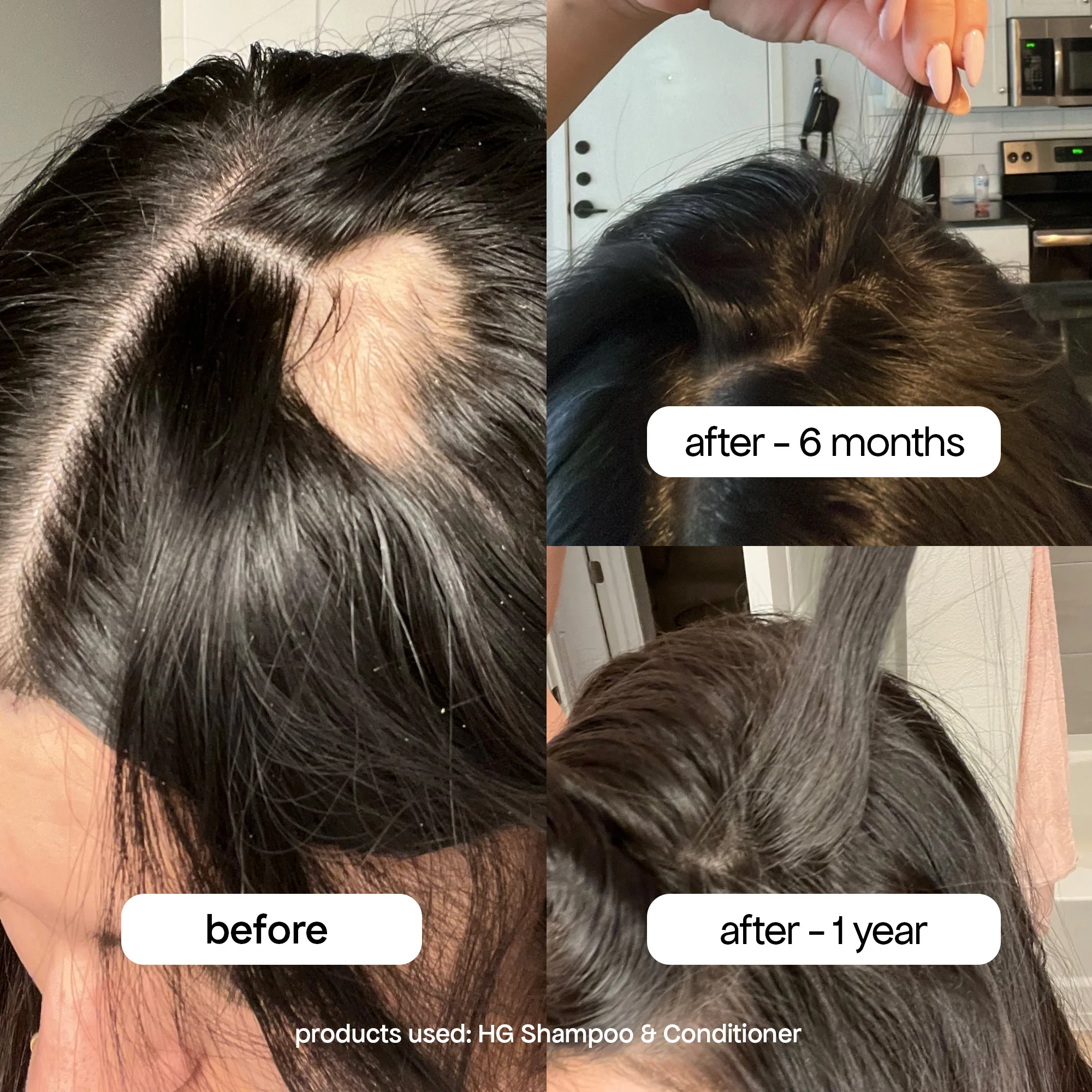 ANTI-THINNING CONDITIONER - Image 12