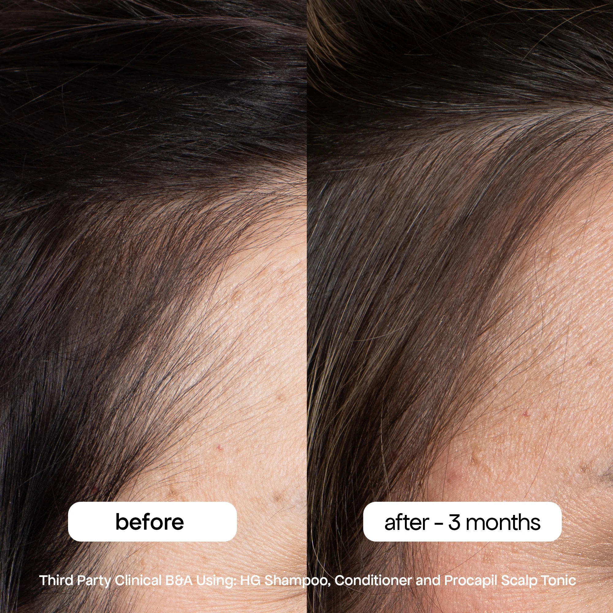 ANTI-THINNING CONDITIONER - Image 6