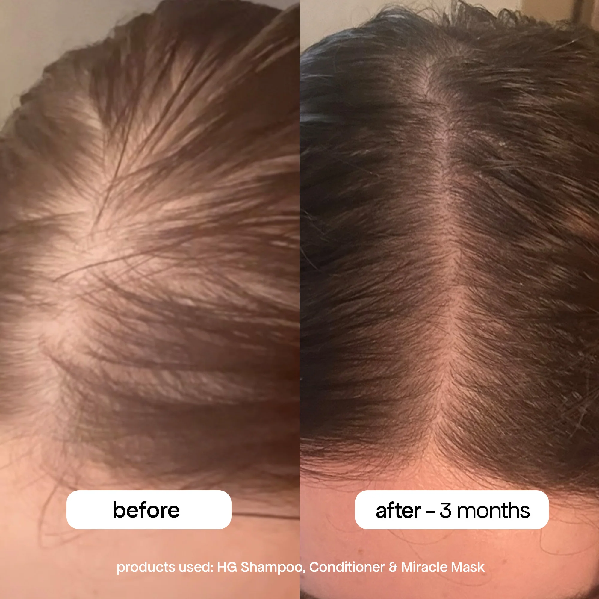 ANTI-THINNING SHAMPOO & CONDITIONER DUO - Image 12