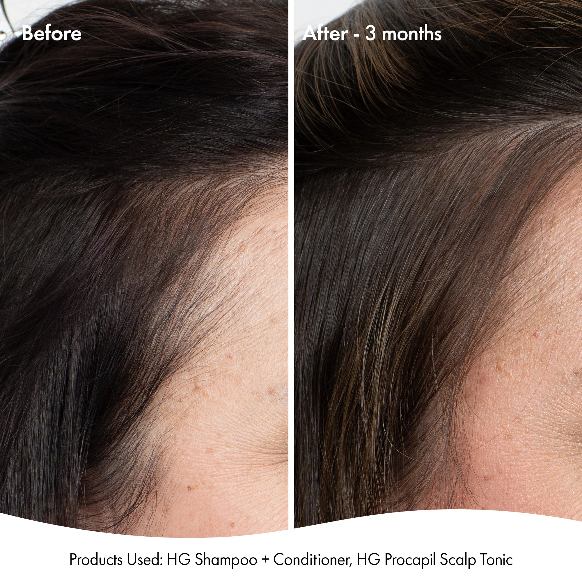 ANTI-THINNING SUPER SYSTEM - Image 3